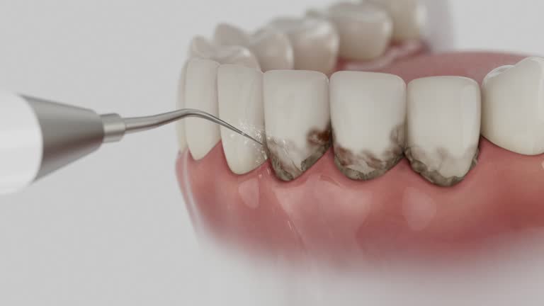 Trusted Emergency Dentist service in Odenton, MD - Dentist Open Now